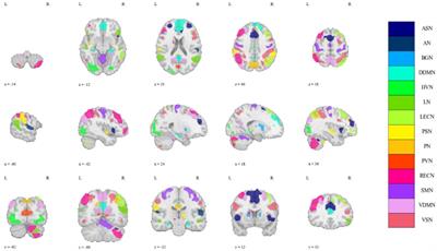 Rich-club organization of whole-brain spatio-temporal multilayer functional connectivity networks